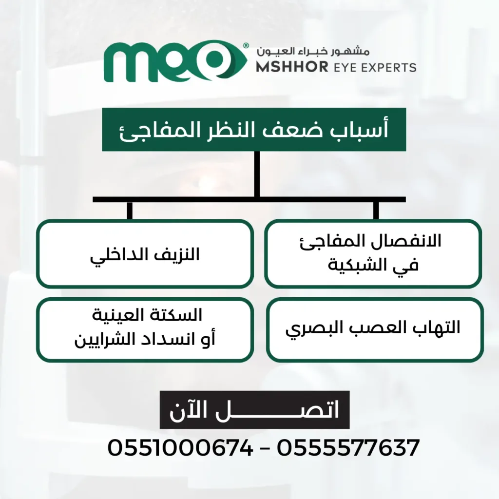علاج ضعف النظر 
