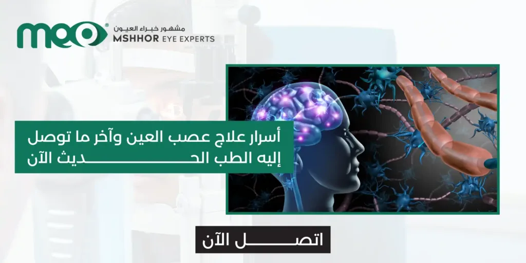علاج عصب العين
