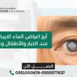 اعراض الماء الابيض في العين