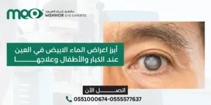 اعراض الماء الابيض في العين