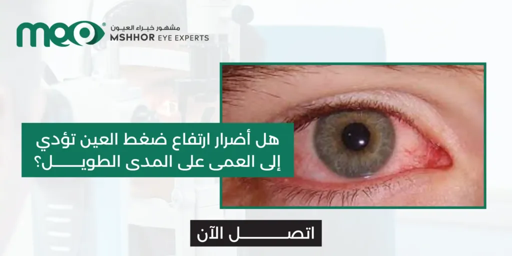 أضرار ارتفاع ضغط العين