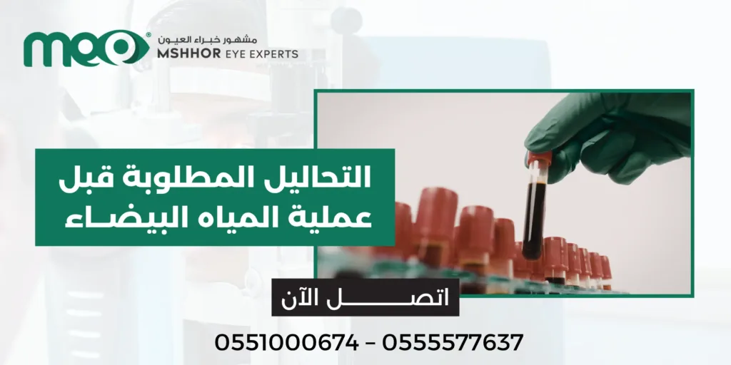 التحاليل المطلوبة قبل عملية المياه البيضاء