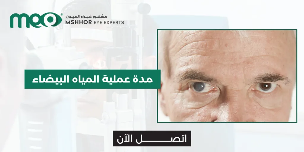 مدة عملية المياه البيضاء