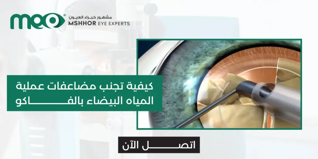 مضاعفات عملية المياه البيضاء بالفاكو