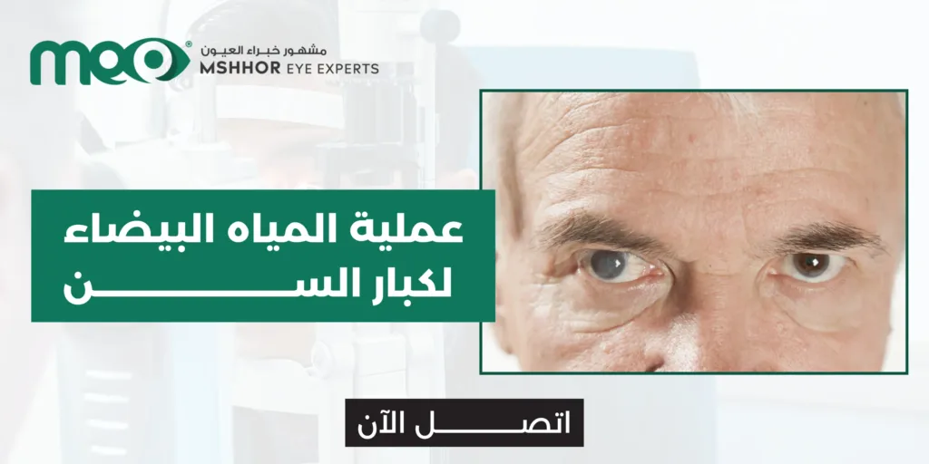 عملية المياه البيضاء لكبار السن