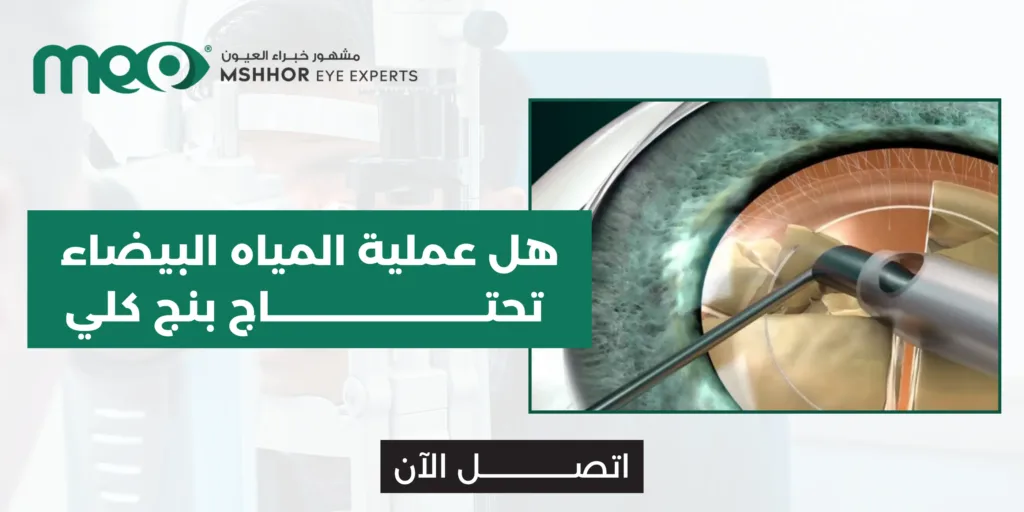 هل عملية المياه البيضاء تحتاج بنج كلي