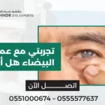 تجربتي مع عملية المياه البيضاء