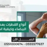 القطرات بعد عملية المياه البيضاء