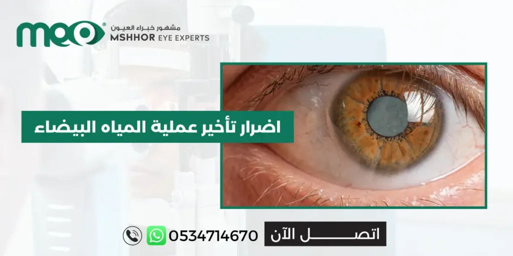 نصائح بعد عملية المياة البيضاء وزرع عدسة
