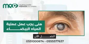 متى يجب عمل عملية المياه البيضاء