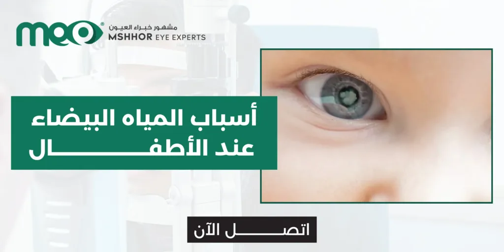 أسباب المياه البيضاء عند الأطفال