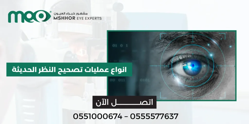 انواع عمليات تصحيح النظر