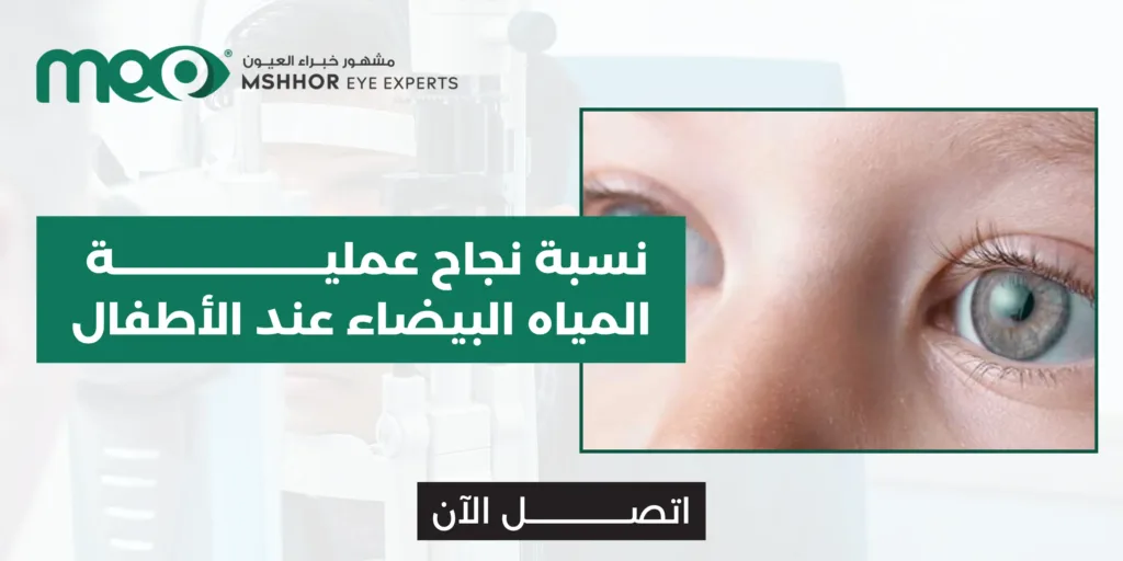 نسبة نجاح عملية المياه البيضاء عند الأطفال