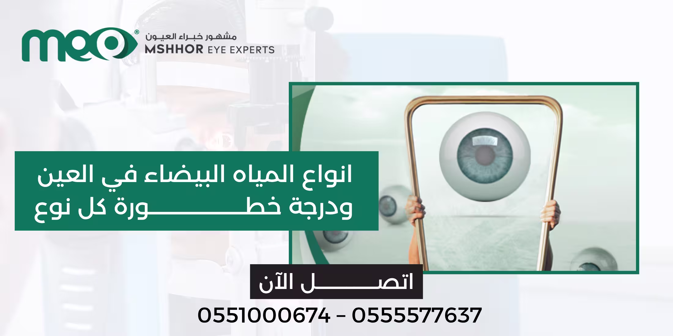 انواع المياه البيضاء في العين