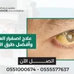 علاج اصفرار العين الخفيف