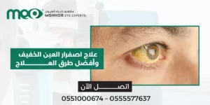 علاج اصفرار العين الخفيف