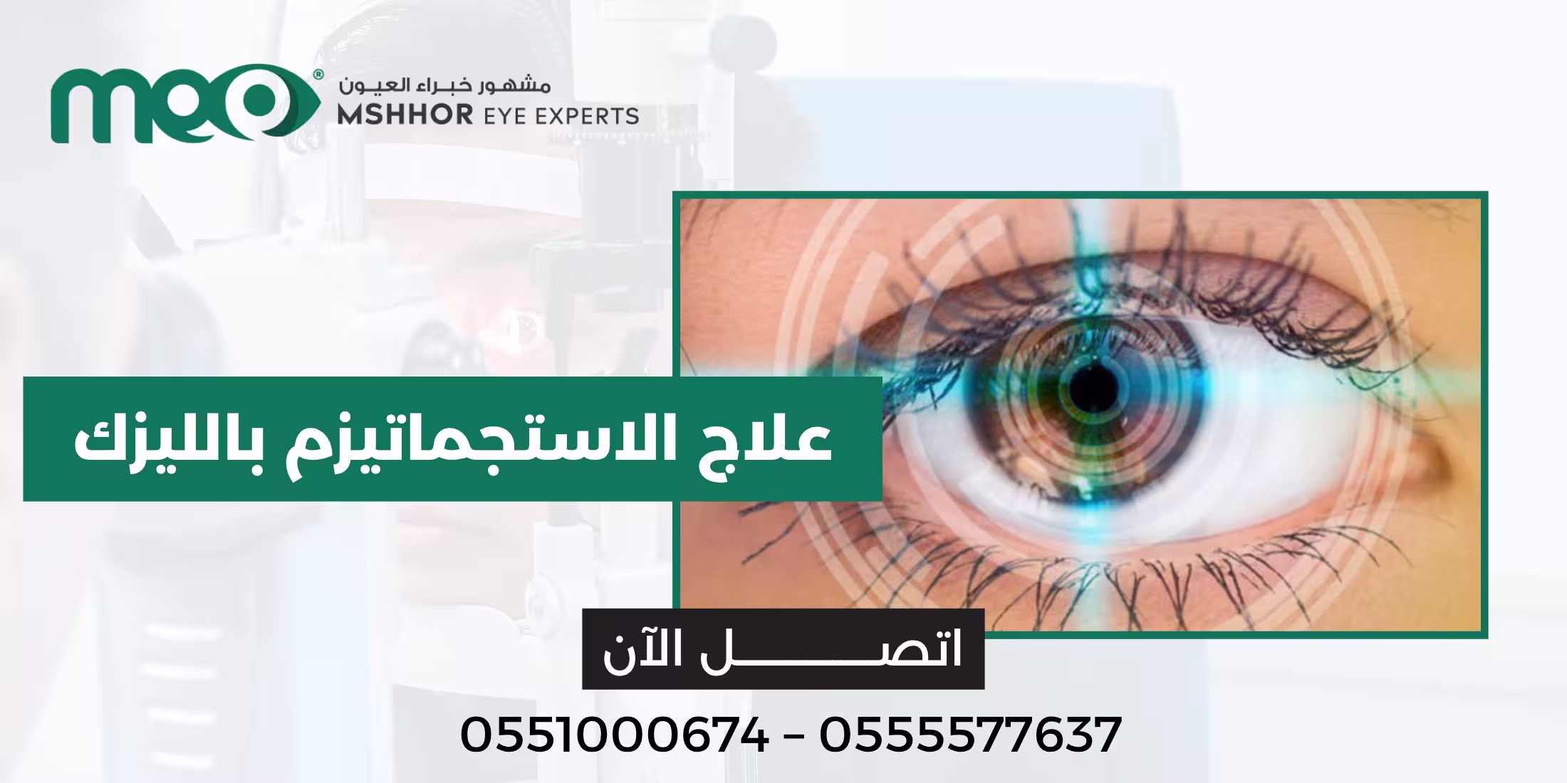 علاج الاستجماتيزم بالليزك
