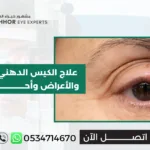 علاج الكيس الدهني بالعين