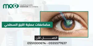 مضاعفات عملية الليزر السطحي