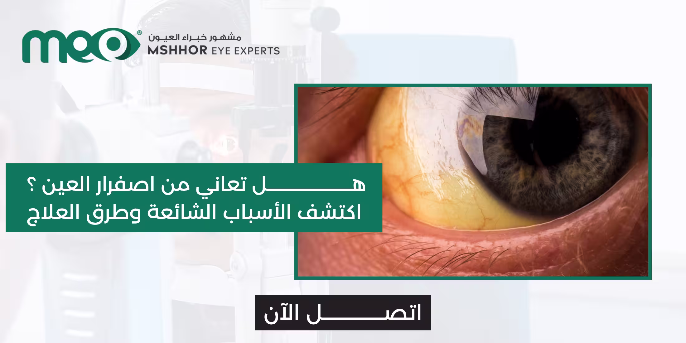 اصفرار العين