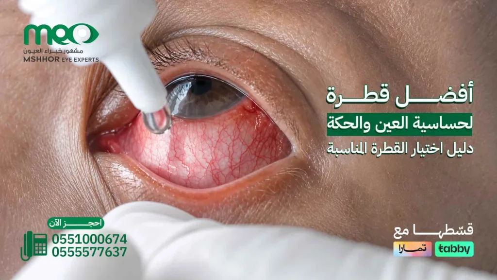 أفضل قطرة لحساسية العين
