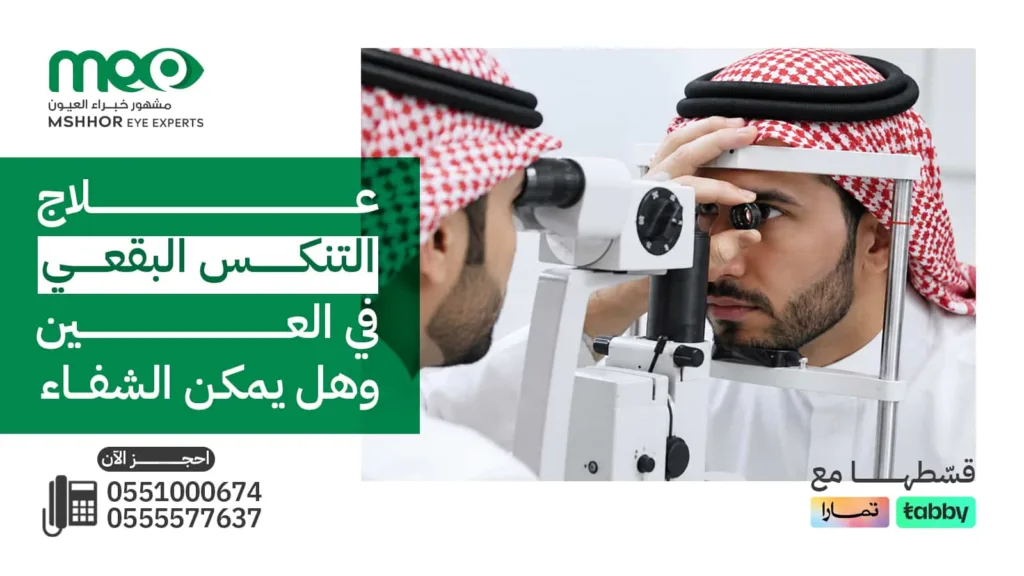 علاج التنكس البقعي في العين