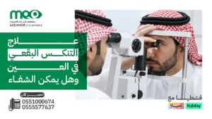 علاج التنكس البقعي في العين