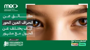 انحراف العين الحور