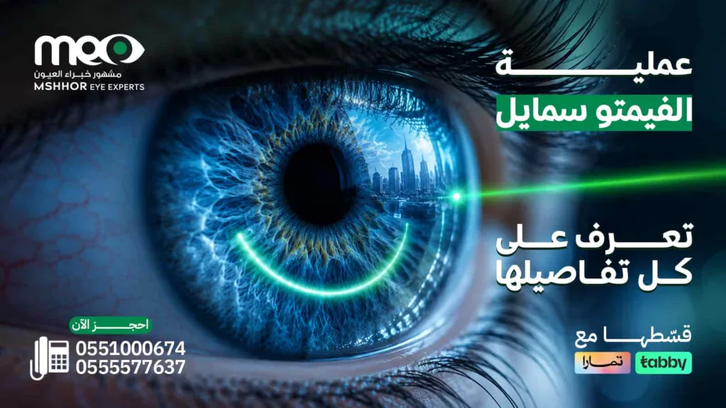 عملية الفيمتو سمايل