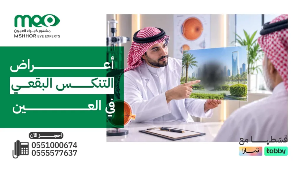 أعراض التنكس البقعي في العين