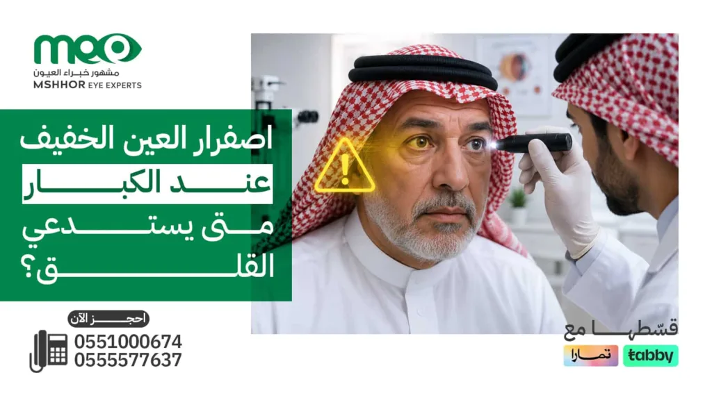 اصفرار العين الخفيف عند الكبار