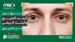 الفرق بين الرمد الحبيبي والرمد الربيعي