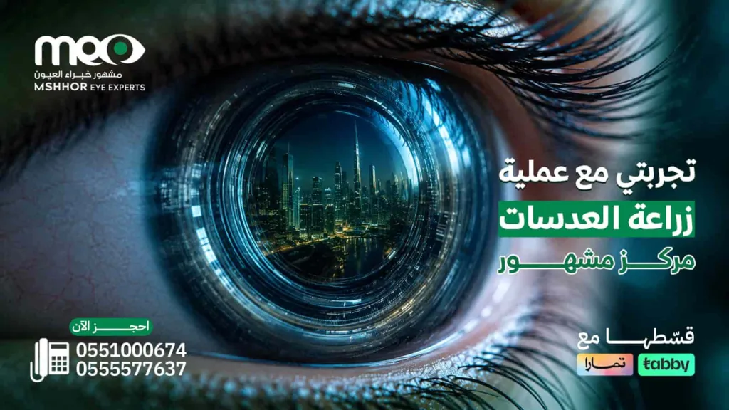 تجربتي مع عملية زراعة العدسات