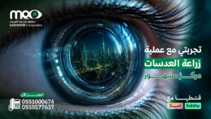 تجربتي مع عملية زراعة العدسات