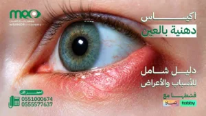 اكياس دهنية بالعين