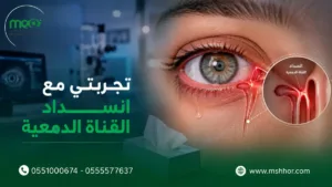 تجربتي مع انسداد القناة الدمعية