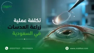 تكلفة عملية زراعة العدسات في السعودية