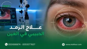 علاج الرمد الحبيبي في العين