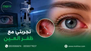 تجربتي مع ظفر العين