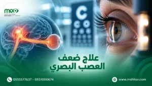 علاج ضعف العصب البصري
