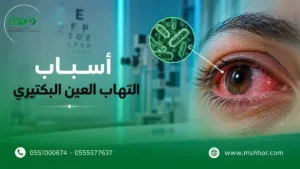 أسباب التهاب العين البكتيري