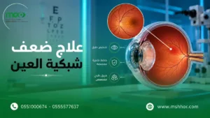 علاج ضعف شبكية العين