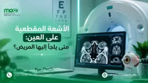 الاشعة المقطعية على العين