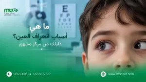اسباب انحراف العين