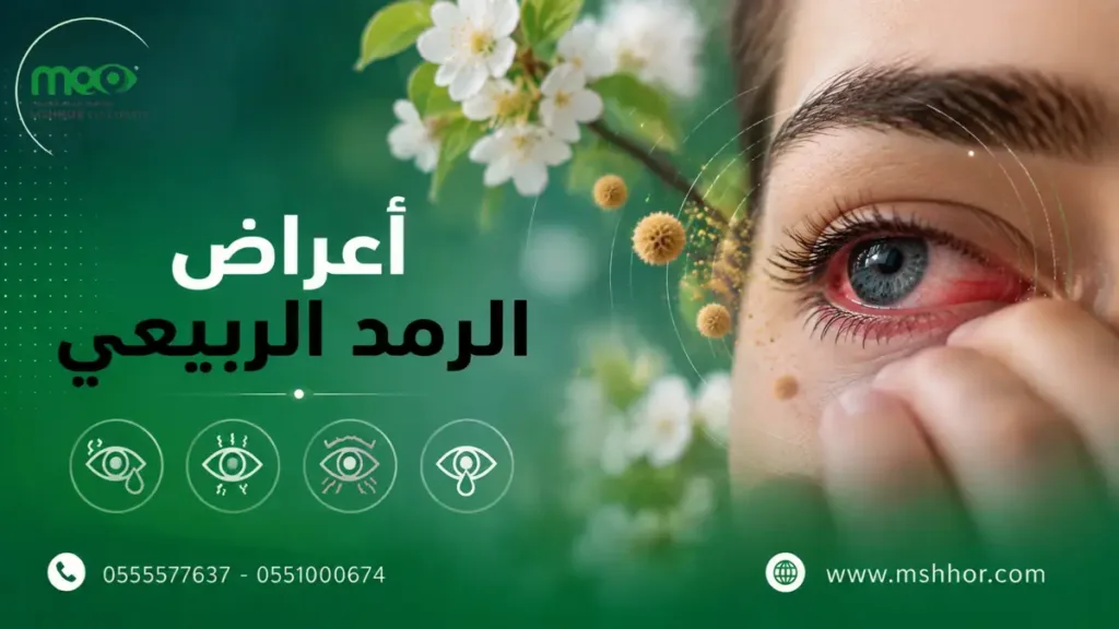 أعراض الرمد الربيعي