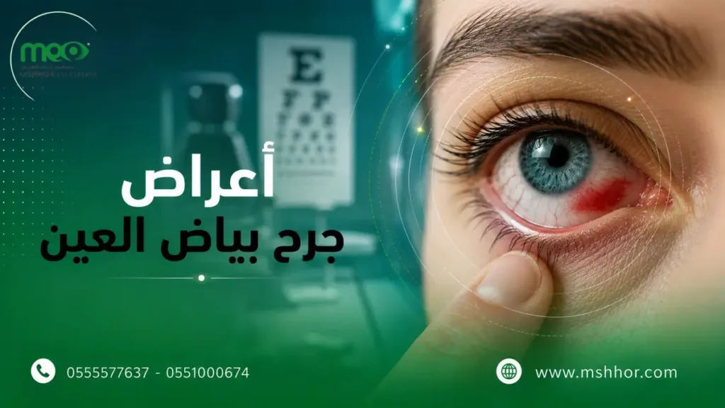 أعراض جرح بياض العين