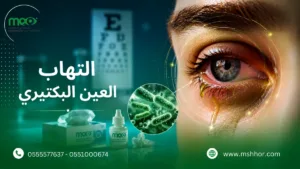 التهاب العين البكتيري
