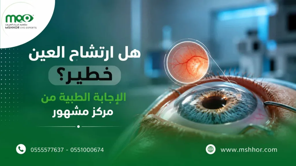 هل ارتشاح العين خطير