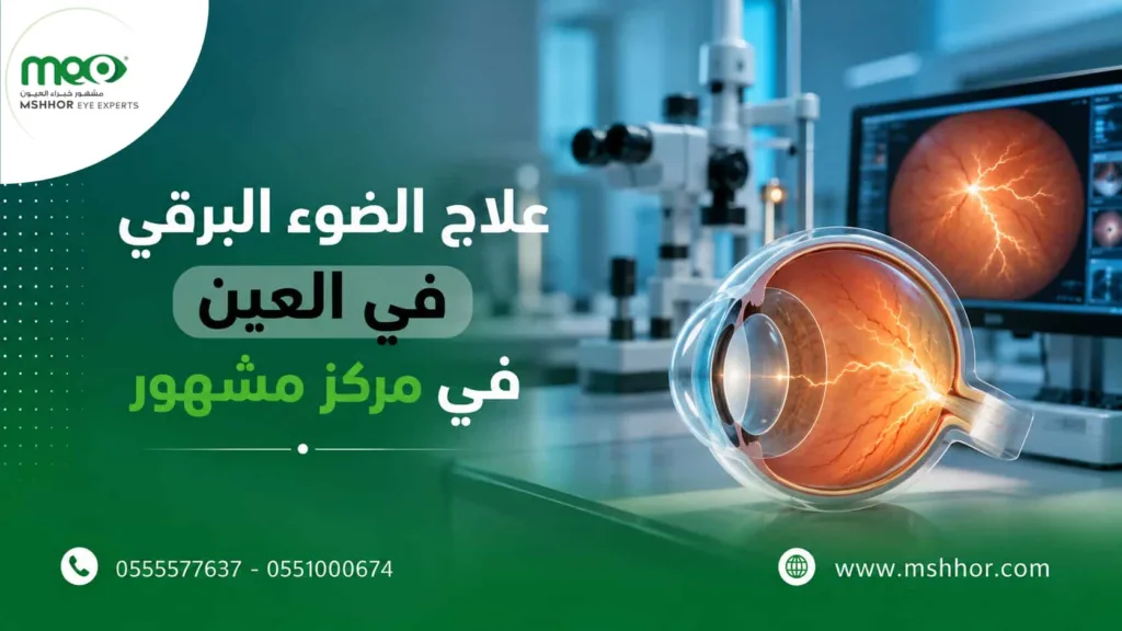 علاج الضوء البرقي في العين