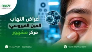 أعراض التهاب العين الفيروسي